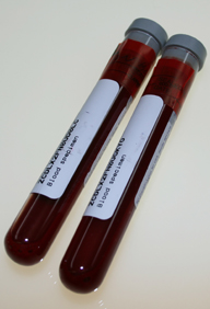 blood_vials